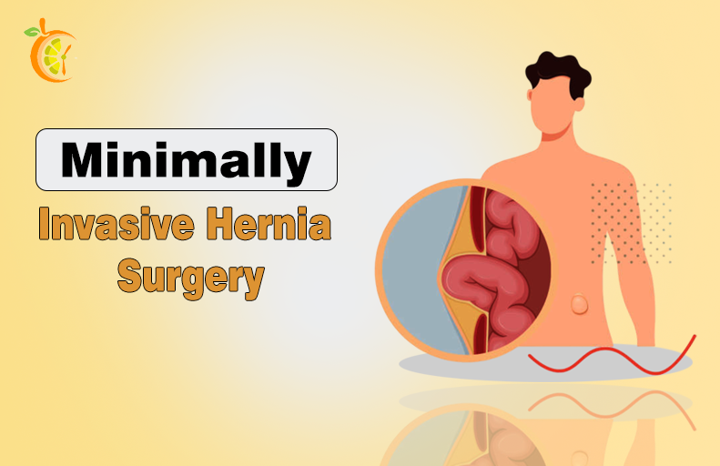 Minimally Invasive Hernia Surgery: Benefits, Techniques, and Recovery Minimally Invasive Hernia Surgery